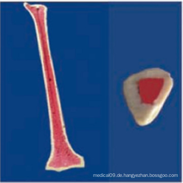 Menschliches Skelett Anatomisches Modell Medizinische Produkte (R010111)